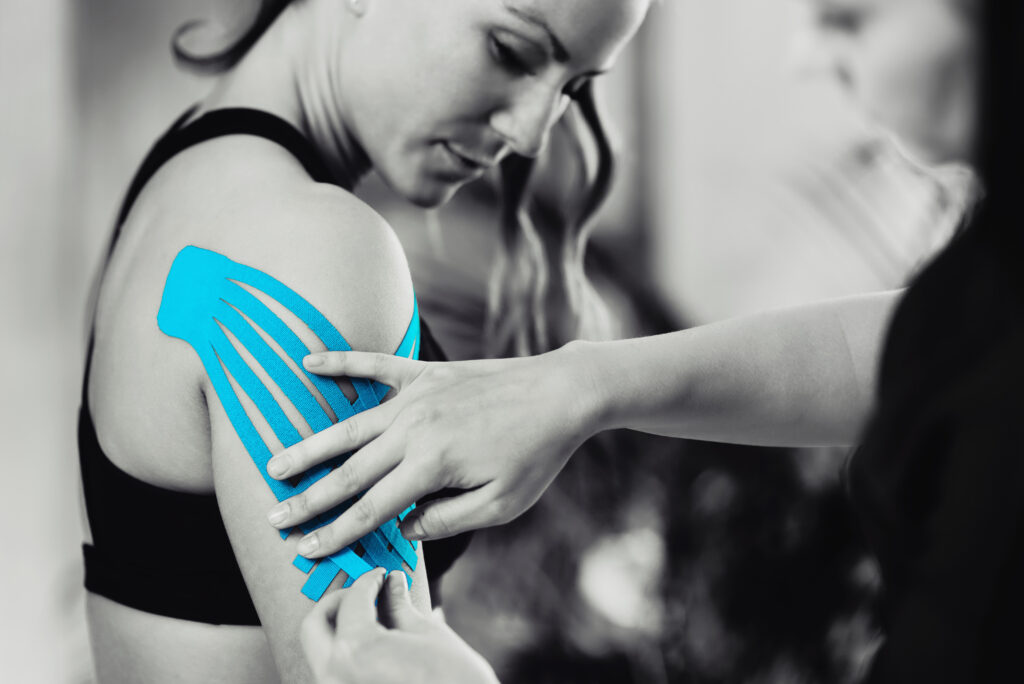 Black and white image of kinesiology taping treatment with blue tape on female patient injured arm. Sports injury kinesio treatment.